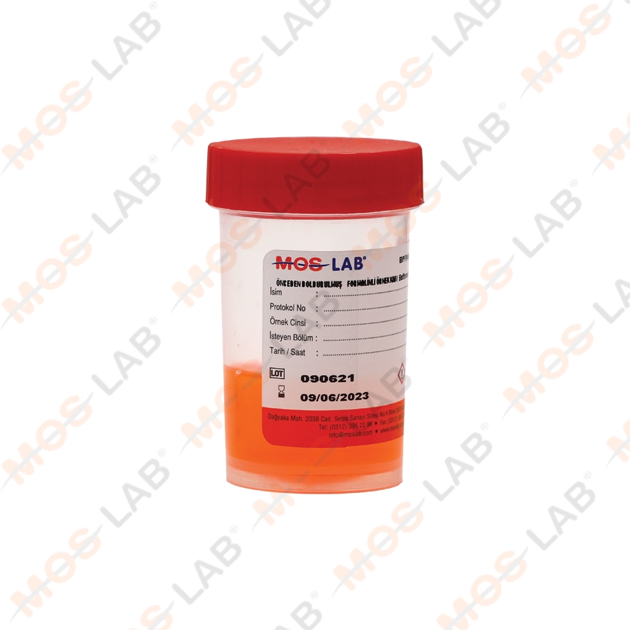 ÖNCEDEN DOLDURULMUŞ FORMALİNLİ ÖRNEK KABI 50 ML