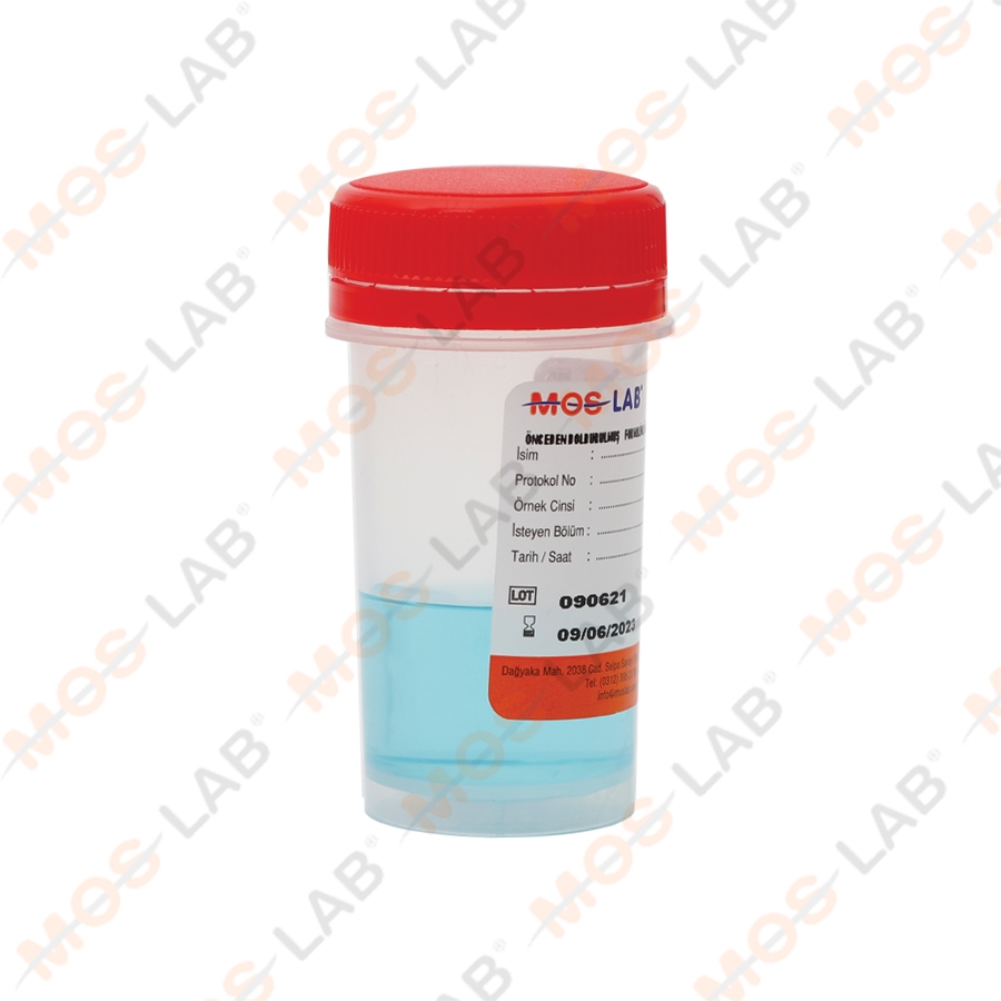 ÖNCEDEN DOLDURULMUŞ FORMALİNLİ ÖRNEK KAPLARI 60 ML