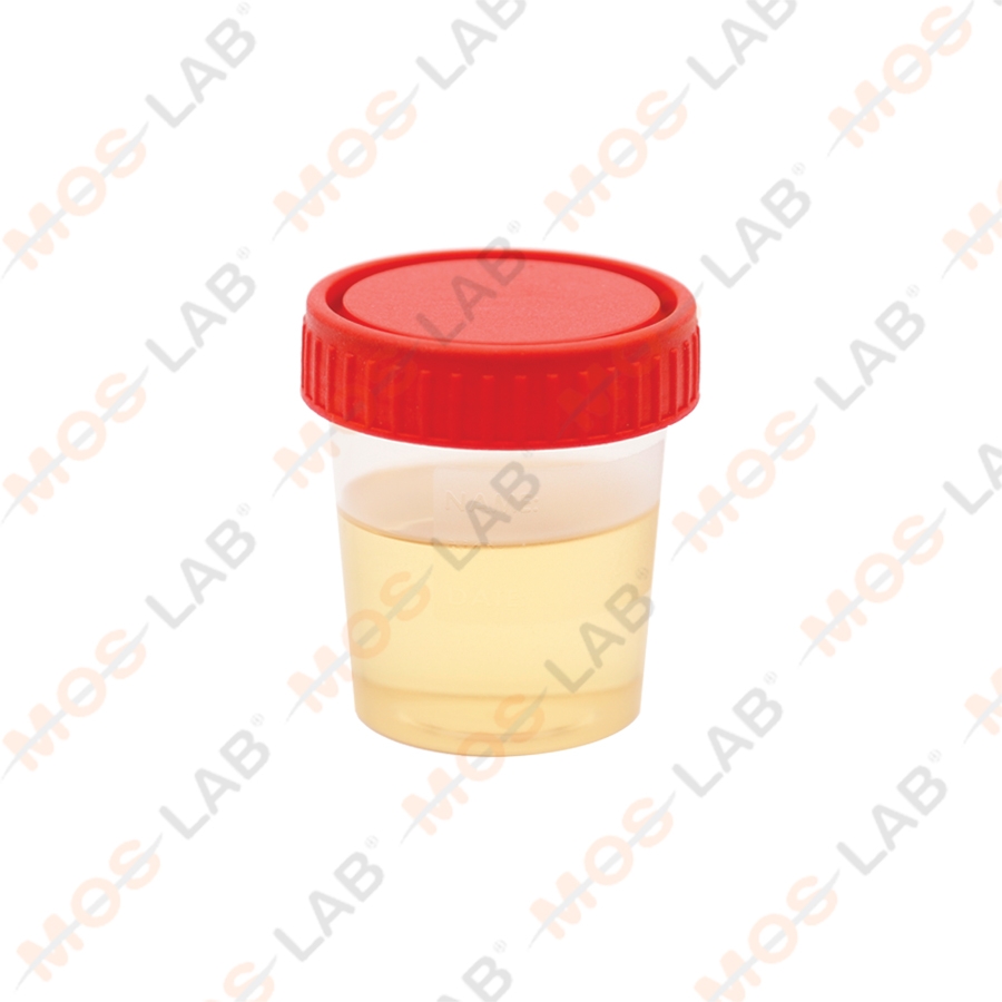 İDRAR BARDAĞI NONSTERİL 100 ml