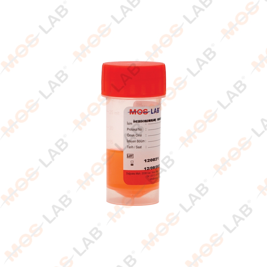 ÖNCEDEN DOLDURULMUŞ FORMALİNLİ ÖRNEK KABI 25-30 ML