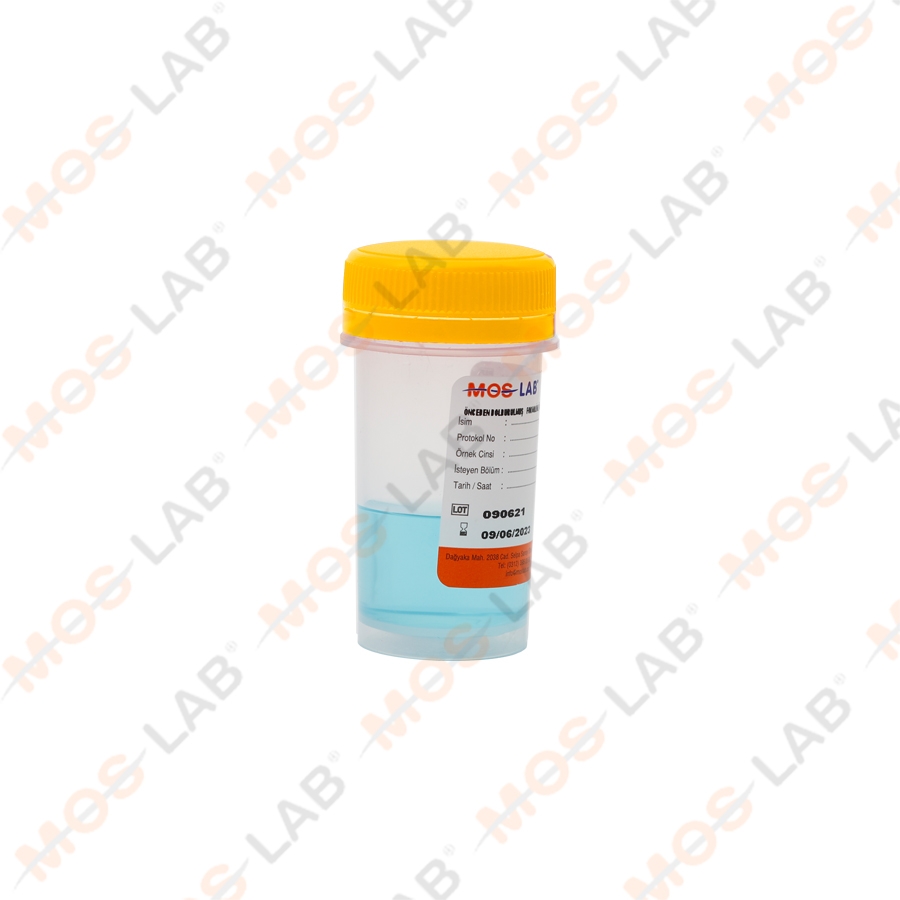 ÖNCEDEN DOLDURULMUŞ FORMALİNLİ ÖRNEK KABI 40 ML